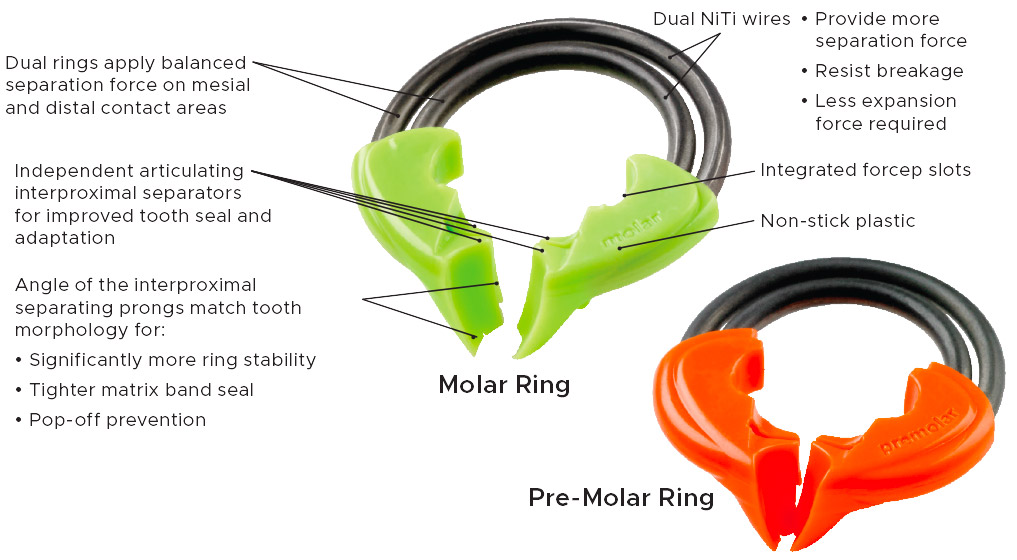 DualForce Molar and Pre-Molar Rings
