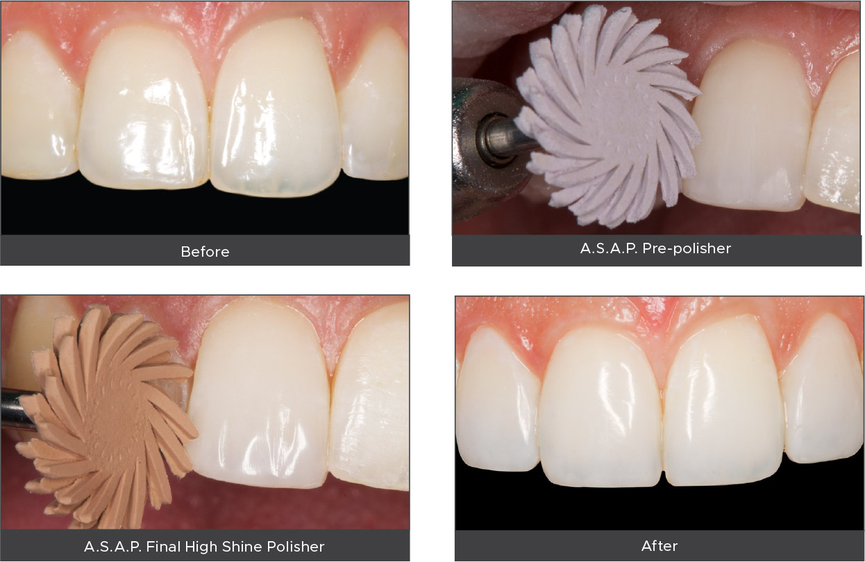 Pre-polisher-Final-High-Shine A.S.A.P. Pre-Polisher