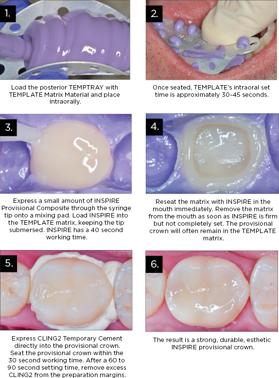 TempTray-Clinical-Technique-Posterior TempTray Clinical Technique
