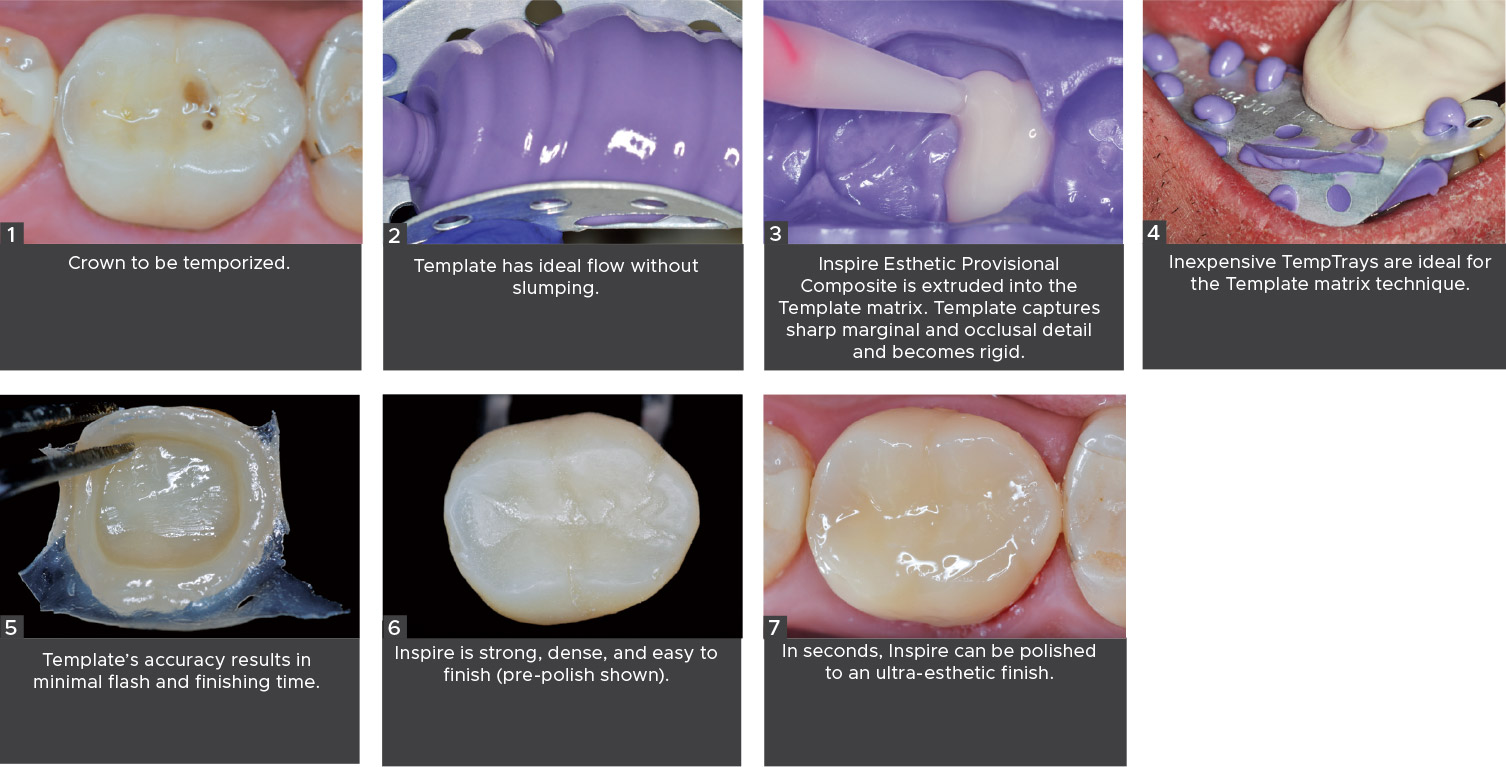Template-Clinical-Technique-Provisional-Crown Template Provisional Crown Technique