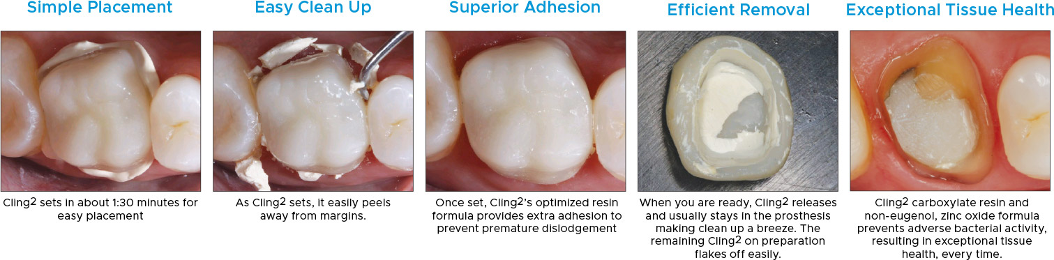 Cling2-Clinical-Technique Cling² Clinical Technique
