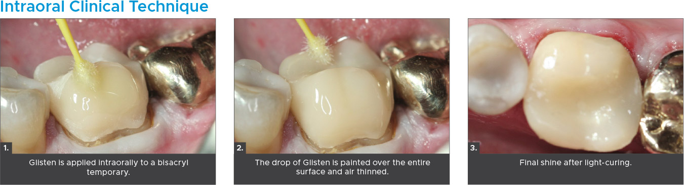 Glisten-Intraoral-Clinical-Technique Glisten Intraoral Clinical Technique