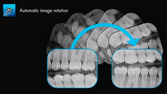 Durr Dental Automatic Image Rotation