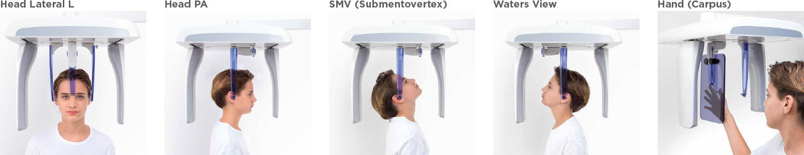 Durr Dental Cephalometric Exposures