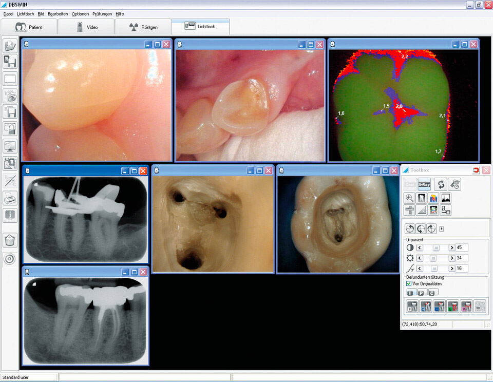 Durr Dental DBSWIN