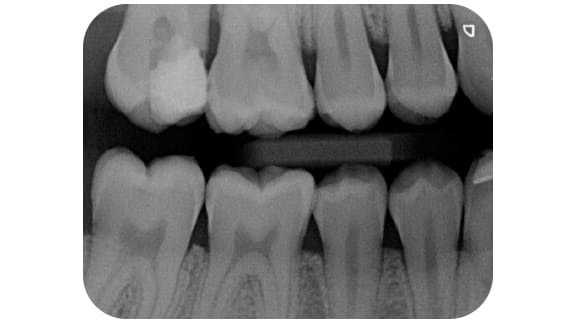 Durr Dental Exceptional Quality