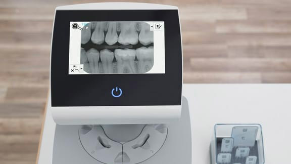 Large-Touchscreen-Ultra-View Durr Dental Large Glass Touchscreen Display