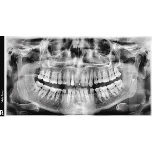 Durr Dental Panorama X-Ray Programs