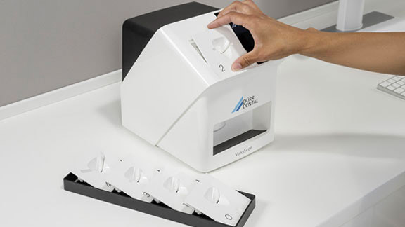 Durr Dental Quick and Easy Scanning