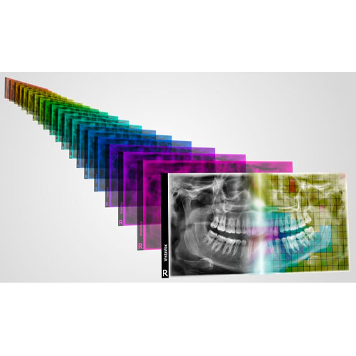 Durr Dental S-Pan Technology