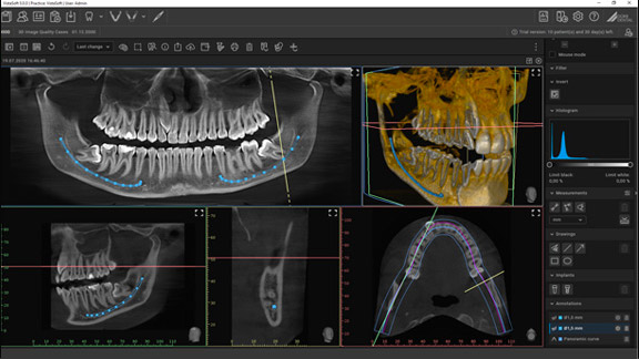 Durr Dental VistaSoft 3D