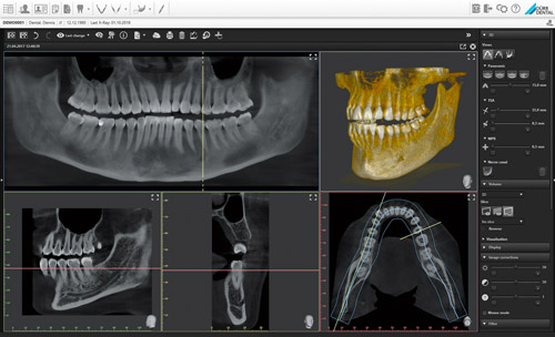 Durr Dental VistaSoft 3D