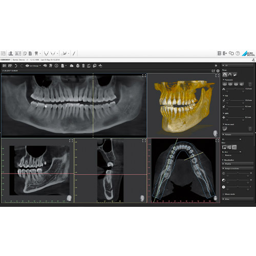 Durr Dental VistaSoft 3D