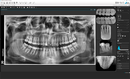 Durr Dental VistaSoft X-ray