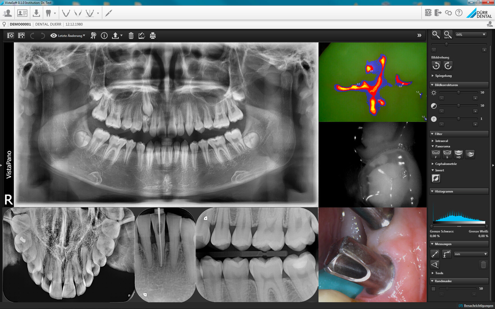 Durr Dental VistaSoft