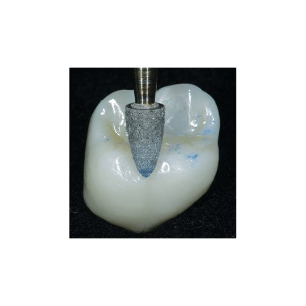 Clinician's Choice A.S.A.P. Indirect+ Intraoral Polishers Point Adjusters RA (3)