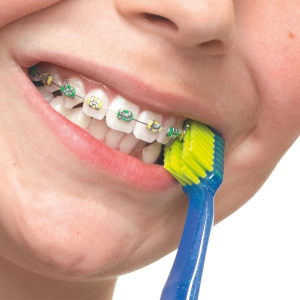 Curaprox CS 5460 Ortho Ultra Soft Toothbrush Individually Wrapped
