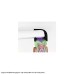 Durr VistaCam iX HD Smart Spacers for Interchangeable Heads (5)