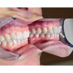 Medesy Photographic Mirror Palatal No. 17 70mm x 95mm (WxL)