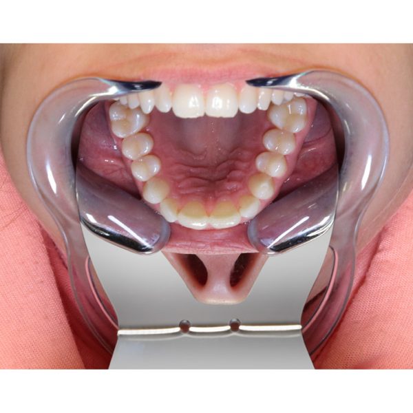 Medesy Photographic Mirror Palatal Small No. 18 55mm x 75mm (WxL)