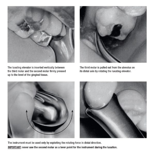 Medesy Luxating Instrument Lussatore for Upper Third Molar