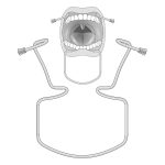 Medesy Mouth Gag Oringer No. 3 Large 60mm x 115mm