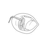 Medesy Retractor Obwegeser Internal No. 3 10mm x 42mm 210mm