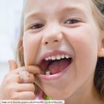 3M Solventum Stainless Steel First Primary Molar Crown Lower Right No. D-LR-3 (2)