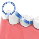 Micro Tech Silicone Dental Floss (12)