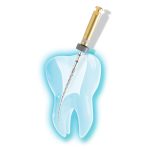 Thomas NiTiShaper 25mm No. T1 White (3)