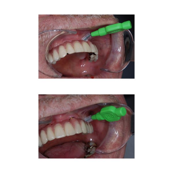 TePe Interdental Brushes Original ISO Size 5 Wire Size 0.80mm Green (8)