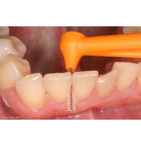 TePe Angle Interdental Brushes ISO Size 1 Wire Size 0.45mm Orange (25)