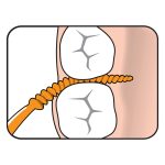 TePe EasyPick Extra Small/Small Orange 2's Dispenser Pack (200)