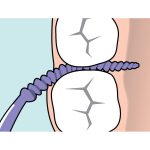 TePe EasyPick Extra Large Purple Blister Pack (36)