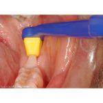 TePe Interspace Medium Toothbrush Blister Pack