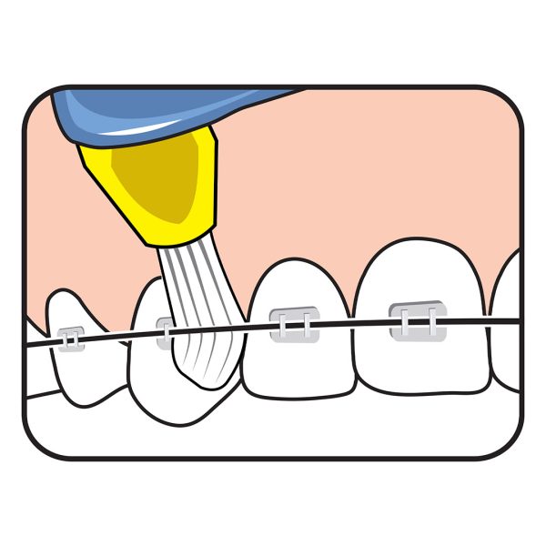 TePe Interspace Medium Toothbrush Blister Pack