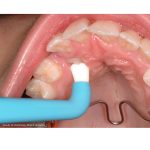 TePe Compact Tuft Toothbrush Individually Wrapped