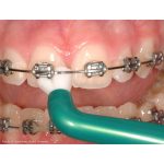 TePe Compact Tuft Toothbrush Blister Pack