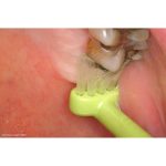 TePe Universal Care Toothbrush Blister Pack