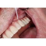 TePe Bridge & Implant Floss Samples (100)