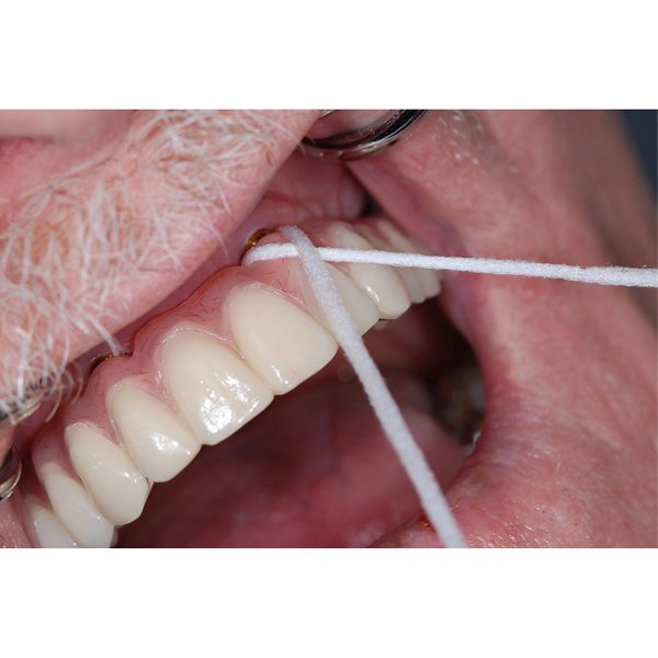TePe Bridge & Implant Floss Samples (100)