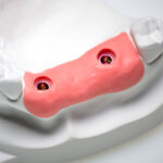 Zhermack Gingifast Rigid A-Silicone 50ml Cartridge (2)