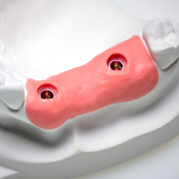 Zhermack Gingifast Rigid A-Silicone 50ml Cartridge (2)