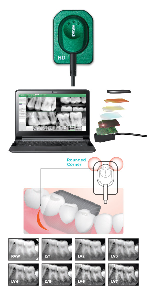 Vatech EzSensor HD Intraoral Scanner