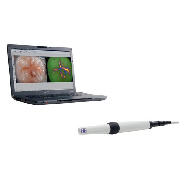 Durr VistaCam iX Intraoral Camera Durr VistaCam iX Intraoral Camera