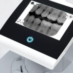 Durr VistaScan Ultra View PSP Phosphor Plate Scanner