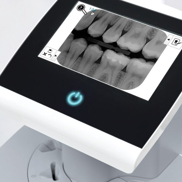 Durr VistaScan Ultra View PSP Phosphor Plate Scanner