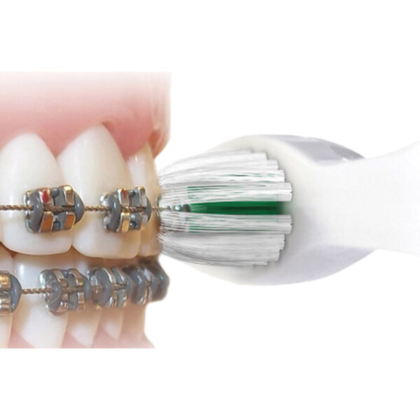 Platypus Platy Pak Orthodontic Flosser & Toothbrush Starter Kit