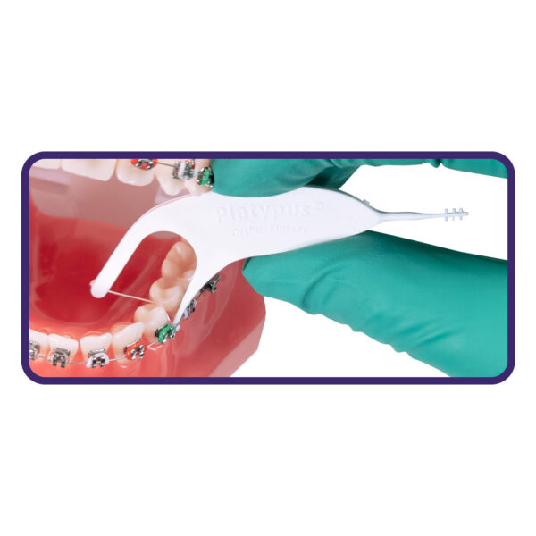 Platypus Platy Pak Orthodontic Flosser & Toothbrush Starter Kit