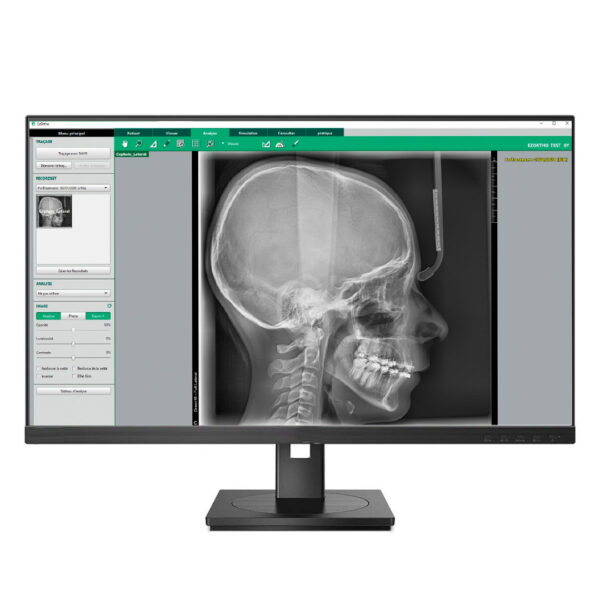 Vatech Software EzOrtho Vatech Software EzOrtho
